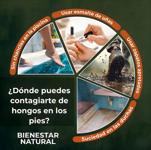 Uñas Sin Hongos